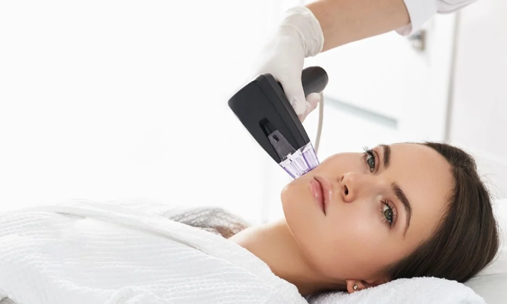 Patient getting Morpheus8 treatment in Destin, FL to reduce wrinkles and fine lines for smoother, youthful-looking skin.