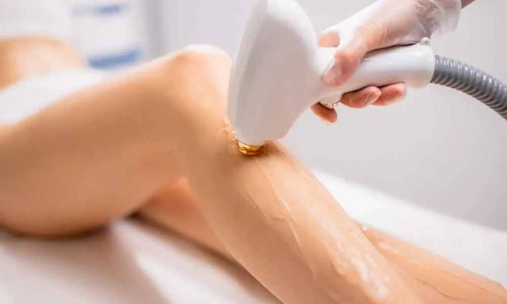 Hair-Removal-At-Vivana-Md